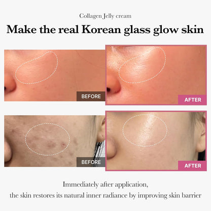 K-Glow Booster Kit