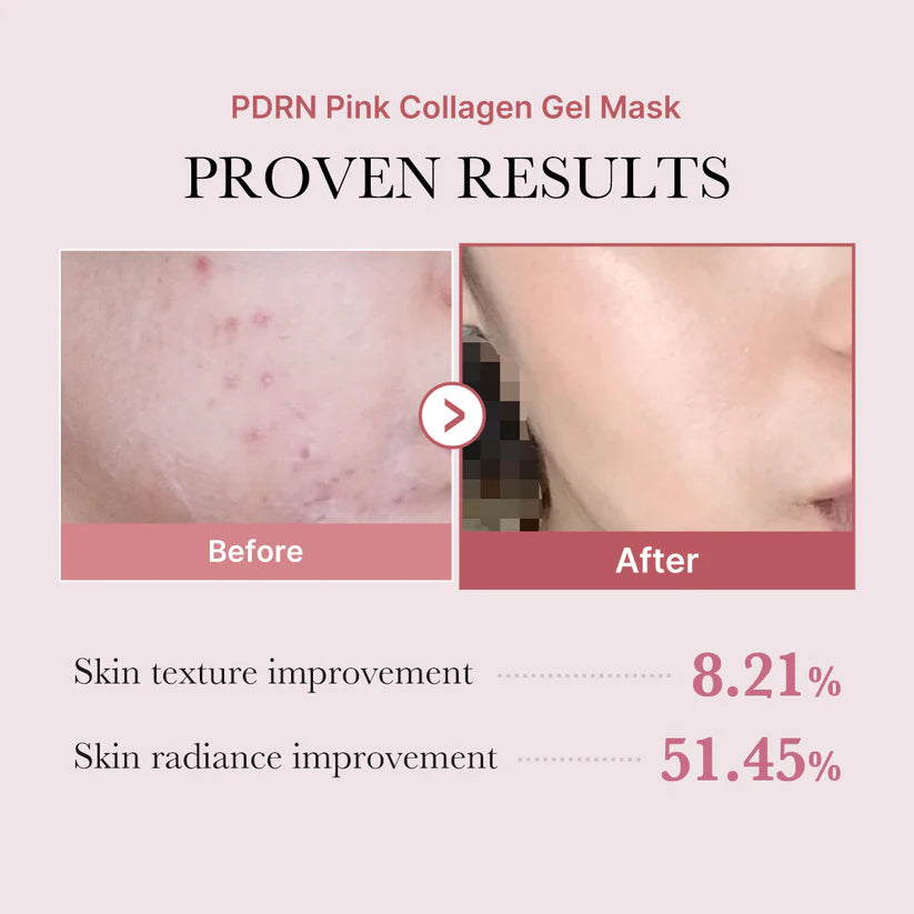 PDRN Pink Glow Full Set