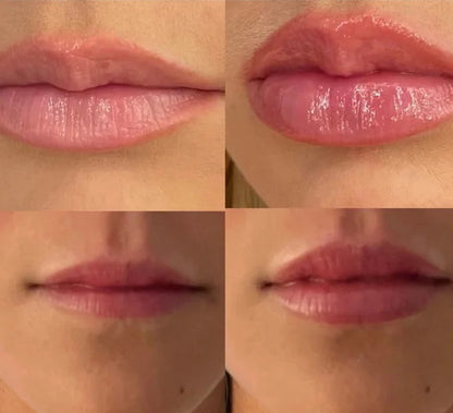 The Lip Gizmo